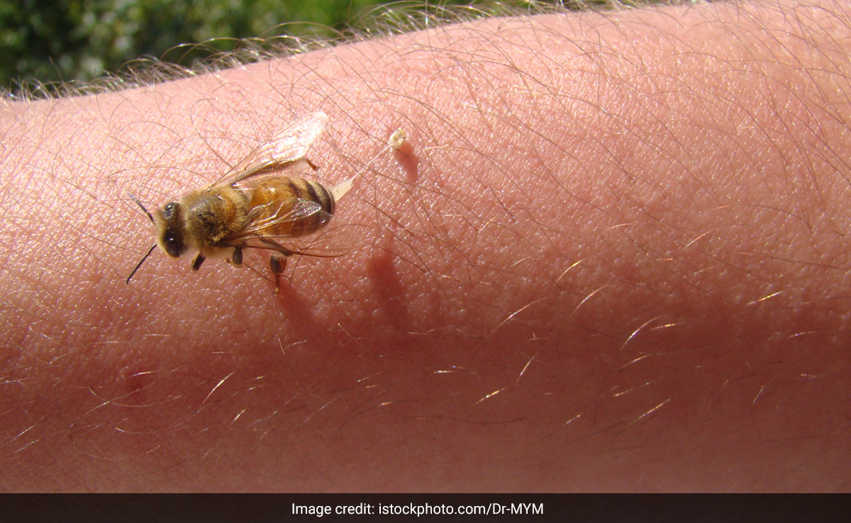 बारिश के मौसम में मधुमक्खी ने काट लिया है तो अपनाएं यह घरेलू उपाय, झट से उतर जाएगी सूजन