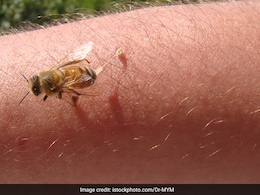 Explainer: मधुमक्खी काट ले तो क्या करें, दर्द और सूजन से बचने के उपाय, जानें कितना खतरनाक हो सकता मधुमक्खी का डंक?