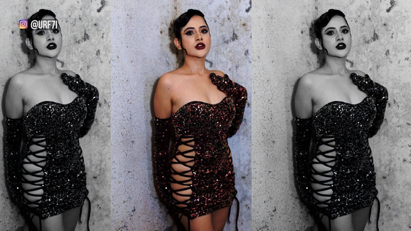 उर्फी जावेद से पहले भी कई सितारे करवा चुके हैं लिप फिलर्स