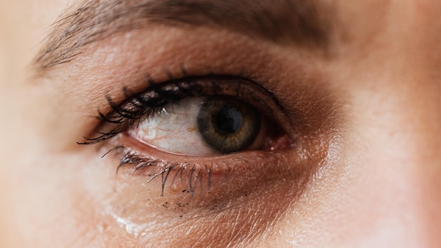 Conjunctivitis Surge in Chennai