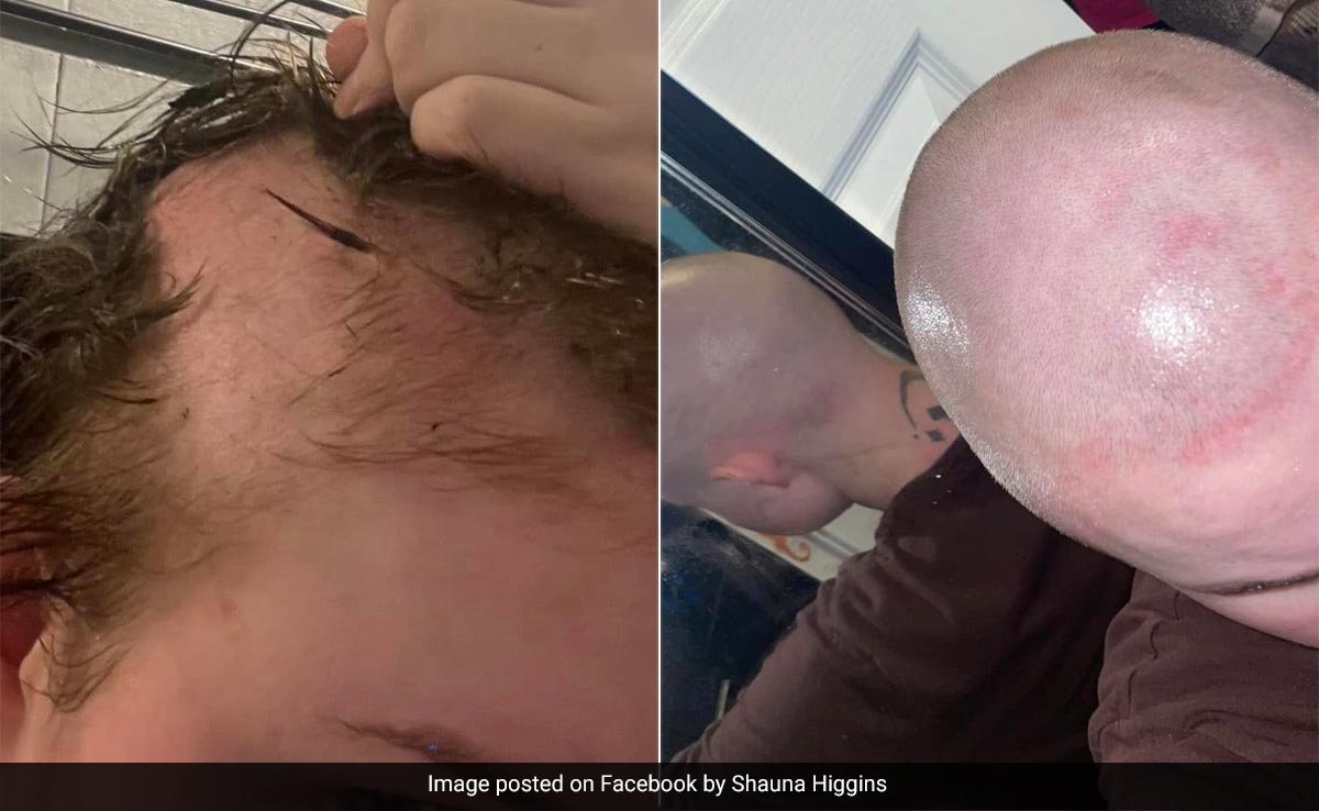 UK Woman Forced To Shave Head, Claims Botched Hair Extension Left Her Bald