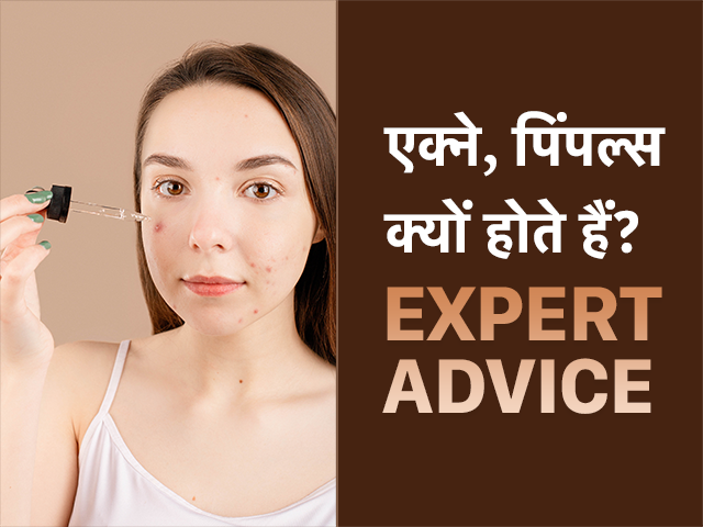 बालों की सेहत आपके चेहरे को बना सकती है दानों का घर, यहां जानें कैसे करना है बचाव