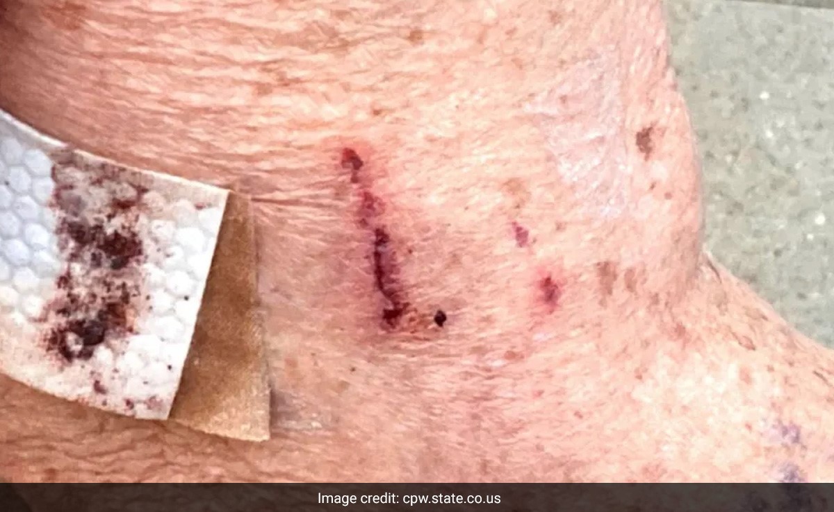 Bear Breaks Into Home, Attacks 82-Year-Old Woman In Colorado