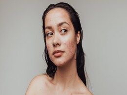 ये 3 DIY स्किन टोनर आपके चेहरे से एक्सेस ऑयल एकबार में देंगे हटा, आजमाकर देखिए  ये 3 DIY स्किन टोनर आपके चेहरे से एक्सेस ऑयल एकबार में देंगे हटा, आजमाकर देखिए