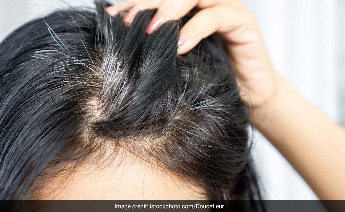 सफेद बालों के लिए नारियल तेल का किया जा सकता है इस्तेमाल, जानिए कैसे Coconut Oil से जड़ से काले होंगे बाल