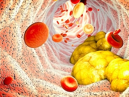 हाई कोलेस्ट्रॉल से आ गए हैं तंग तो डाइट में शामिल कर लीजिए ये 5 फल, Cholesterol कम करने में मिलेगी मदद हाई कोलेस्ट्रॉल से आ गए हैं तंग तो डाइट में शामिल कर लीजिए ये 5 फल, Cholesterol कम करने में मिलेगी मदद