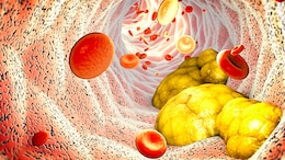 Nutritionist Suggests 9 Dietary Changes Which Naturally Lowers Cholesterol Levels In Body