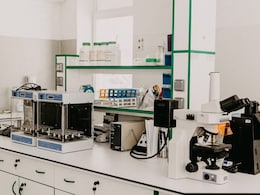 कहीं गलत तो नहीं आपकी लिपिड प्रोफाइल टेस्ट रिपोर्ट, गणित की आसान केल्कुलेशन से समझें कैसे पढ़ते हैं Lipid Profile की रिपोर्ट कहीं गलत तो नहीं आपकी लिपिड प्रोफाइल टेस्ट रिपोर्ट, गणित की आसान केल्कुलेशन से समझें कैसे पढ़ते हैं Lipid Profile की रिपोर्ट