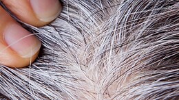 White Hair Remedy: किचन में रखी इस एक चीज से कर सकते हैं सफेद बालों को काला, Hair Mask की विधि जान लीजिए यहां