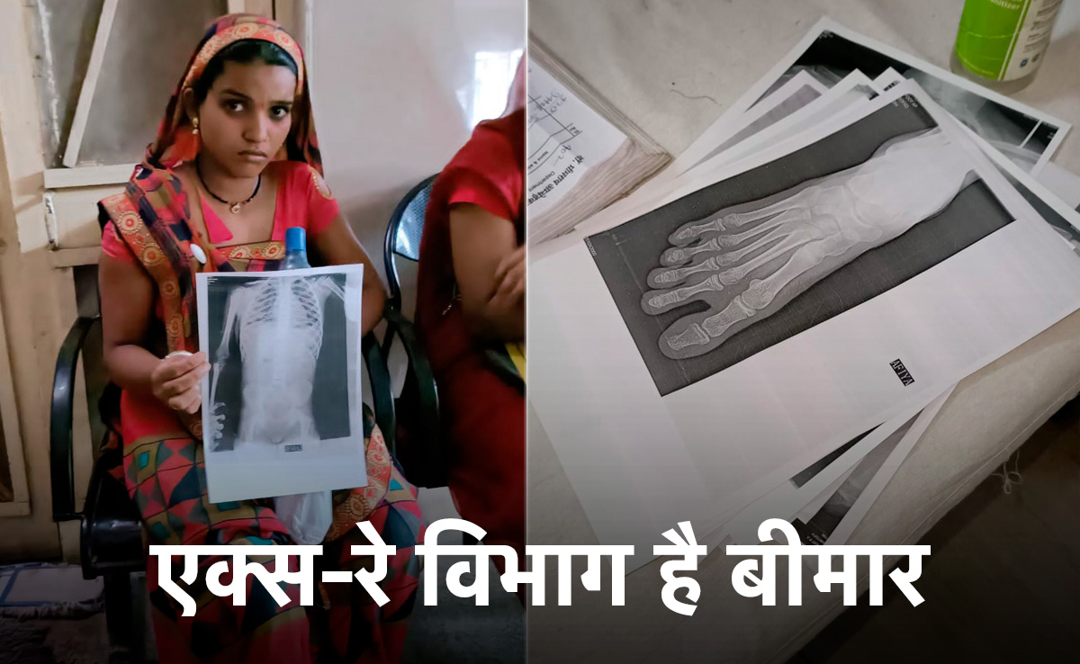 शाजापुर: जिला अस्पताल में कागज पर हो रहे हैं एक्स-रे ! सबूत देखकर भी CMO का इनकार