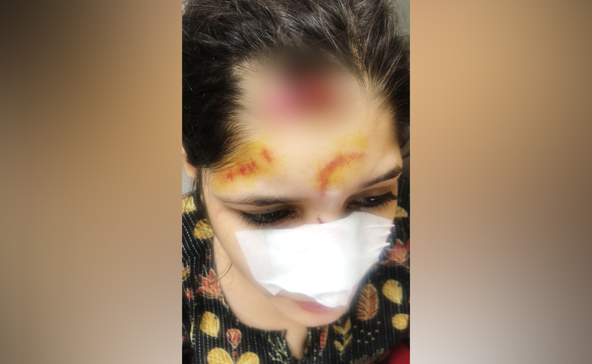 Delhi Teacher Falls Out Of Auto, Dragged On Road In iPhone Snatching Bid