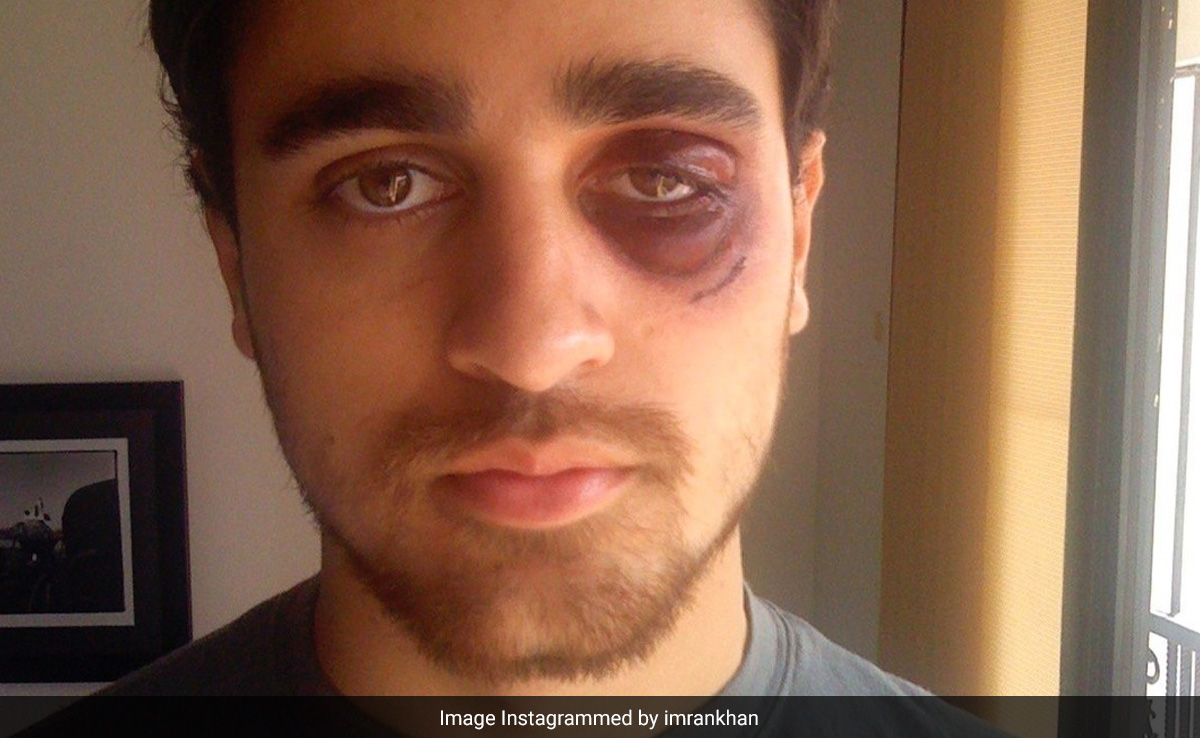 Imran Khan Didn't Think Censor Board Would Pass <i>Delhi Belly</i>. See His BTS Pics