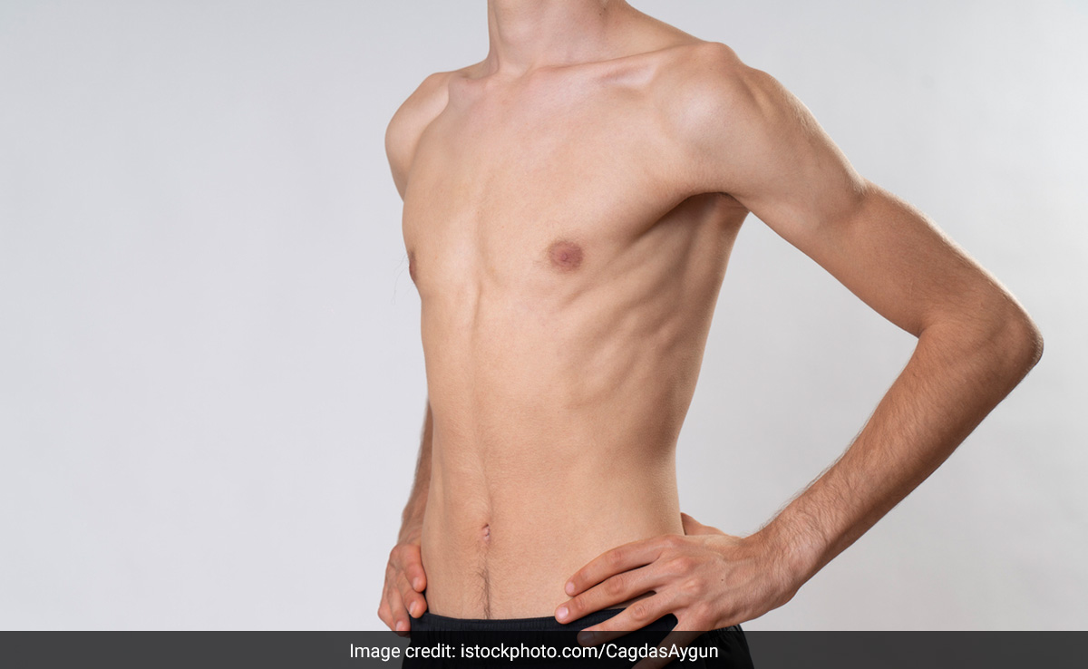 क्या आप भी पतले हैं और फिट होना चाहते हैं? बस खाने में शामिल करें ये चीजें,&nbsp;कमजोरी भी हो जाएगी दूर