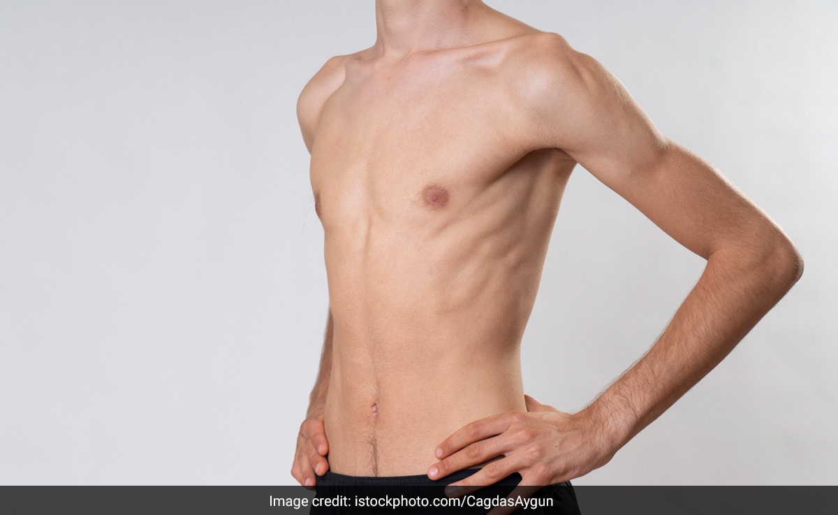 3 महीने में बढ़ेगा 10 किलो तक वजन! Doctor Zaidi ने शेयर किया पूरा डाइट प्लान, आप भी कर लो ये 1 काम