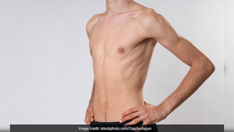 3 महीने में बढ़ेगा 10 किलो तक वजन! Doctor Zaidi ने शेयर किया पूरा डाइट प्लान, आप भी कर लो ये 1 काम