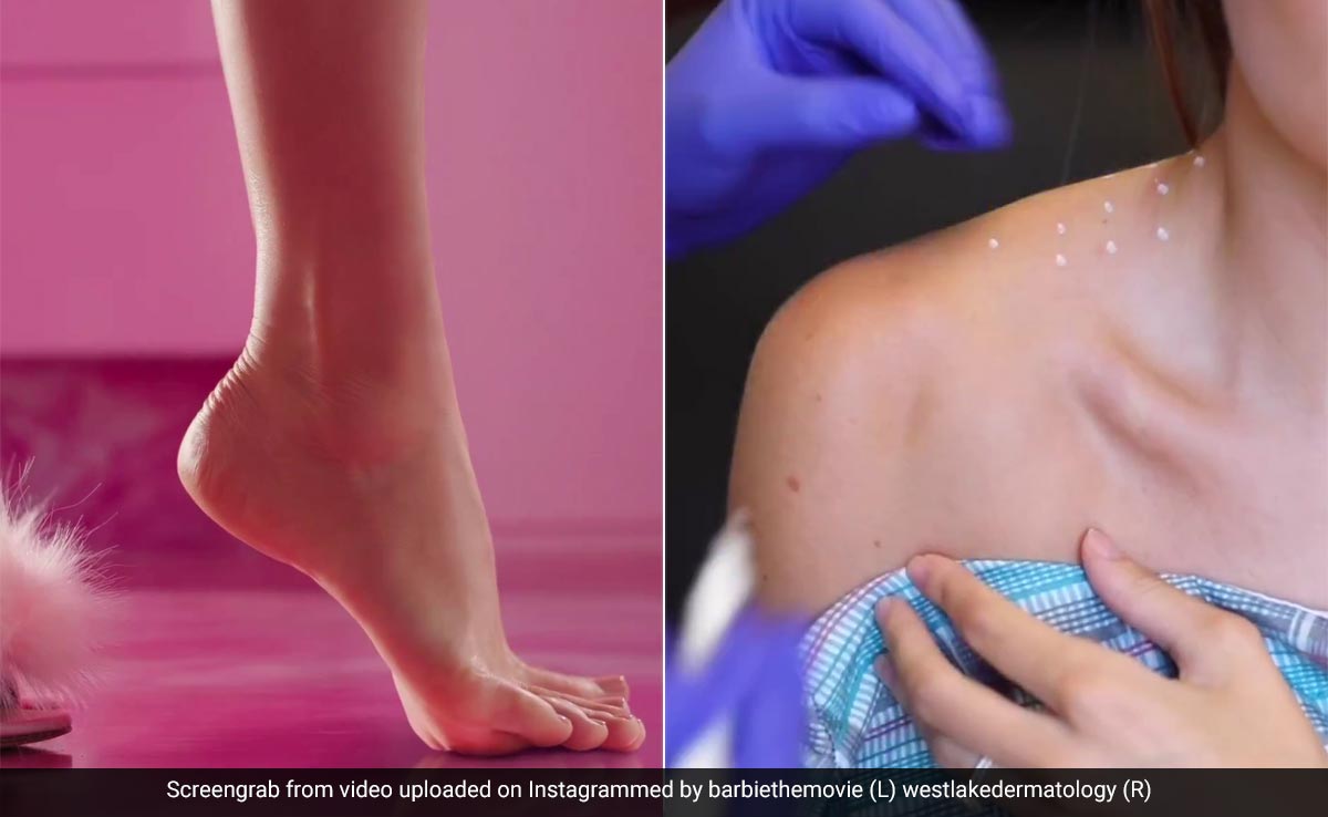Want A Neck Like Barbie? This Viral Beauty Trend And More Take The Barbie Fever Forward