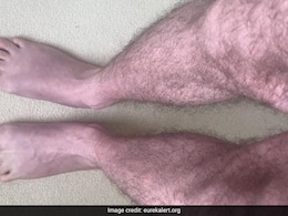 जानिए क्या है रेस्टलेस लेग सिंड्रोम? इन विटामिन्स को डाइट में शामिल कर पा सकते हैं इससे राहत जानिए क्या है रेस्टलेस लेग सिंड्रोम? इन विटामिन्स को डाइट में शामिल कर पा सकते हैं इससे राहत