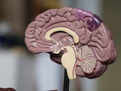 World Alzheimer's Month 2025: Can Some Desi Foods Cut The Risk?