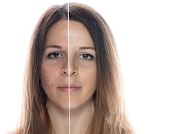 Skin care tips : बढ़ते प्रदूषण से बेहाल है त्वचा? ये 5 स्टेप्स करें फॉलो, कील मुंहासे हो जाएंगे छूमंतर! Skin care tips : बढ़ते प्रदूषण से बेहाल है त्वचा? ये 5 स्टेप्स करें फॉलो, कील मुंहासे हो जाएंगे छूमंतर!