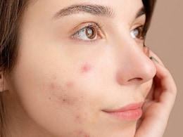 Aloe Vera for Pimples: पिंपल्स की समस्या से हैं परेशान तो एलोवेरा में मिलाकर लगा लें ये चीजें... Aloe Vera for Pimples: पिंपल्स की समस्या से हैं परेशान तो एलोवेरा में मिलाकर लगा लें ये चीजें...