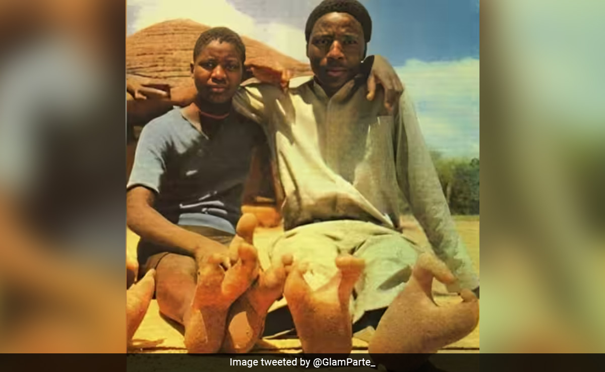 चेहरा इंसानों जैसा, लेकिन पैर 'शुतुरमुर्ग' जैसे, जानें क्या है इसके पीछे की वजह