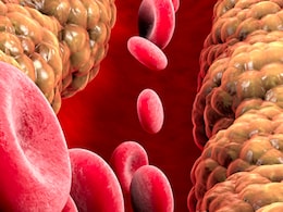 खराब कोलेस्ट्रोल को जड़ से खत्म कर सकतीं हैं यह 4 तरह की दाल, कड़वी दवाईयों की गोली खाने की नहीं पड़ेगी जरूरत