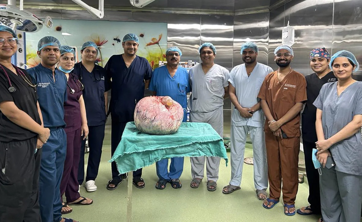 Indore Doctors Find 15-Kg Tumour In Woman Who Complained Of Stomach Ache