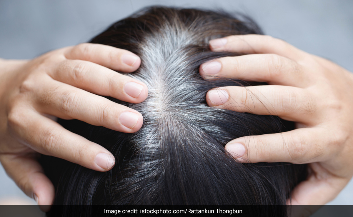 आंवला से भी काले हो सकते हैं सफेद बाल, बस सही तरह से आना चाहिए इस्तेमाल, ऐसे लगाएं Amla डाई की तरह 