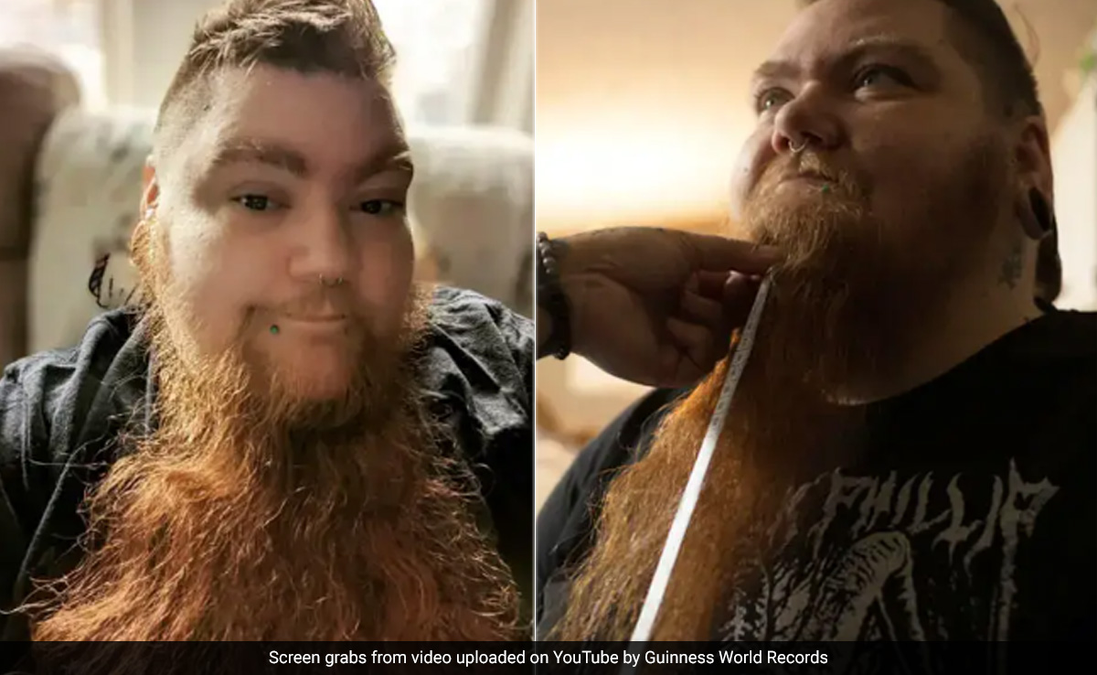 US Woman, Suffering From PCOS, Breaks Guinness World Record For Longest Female Beard