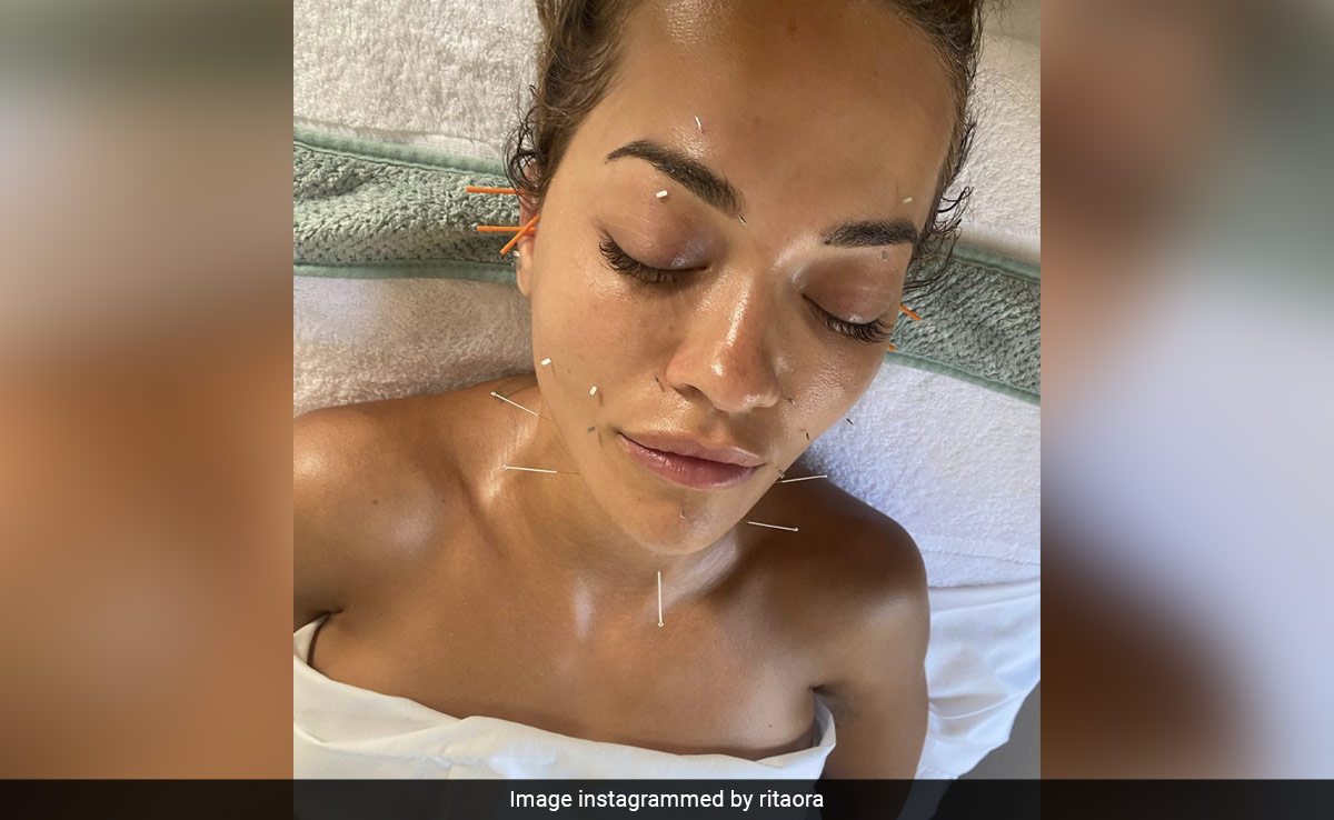 If Beauty Is Pain, Rita Ora's Facial Acupuncture Is Just The Ouch Test To Prove It