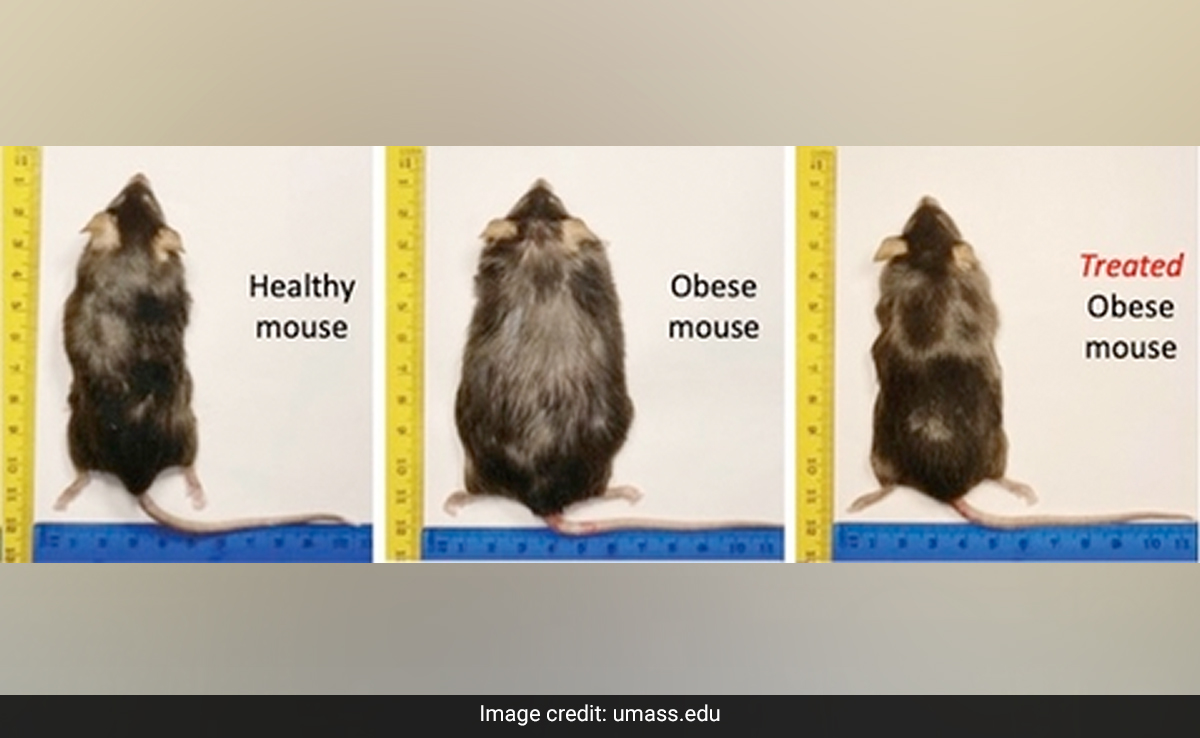 New Weight-Loss Drug Also Lowers Cholesterol Despite High Fat Diet: Study