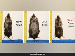 New Weight-Loss Drug Also Lowers Cholesterol Despite High Fat Diet: Study New Weight-Loss Drug Also Lowers Cholesterol Despite High Fat Diet: Study