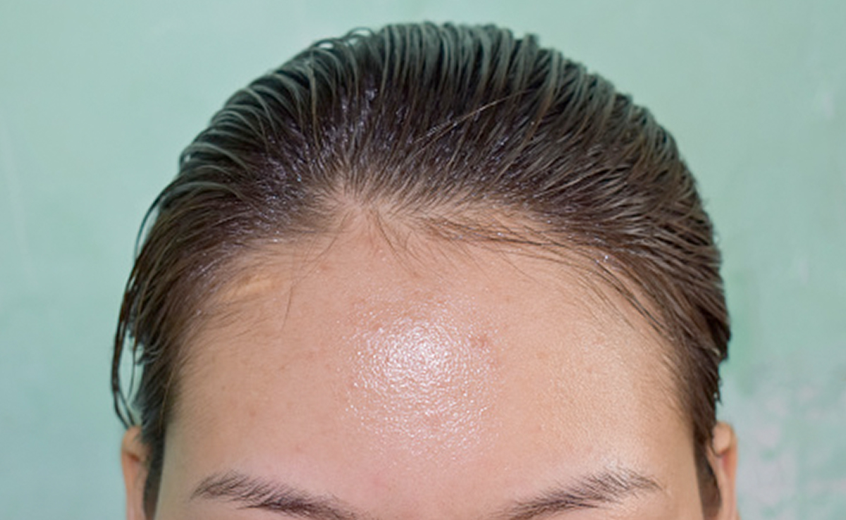 रातभर बालों में तेल लगाकर सोती हैं तो जान लें नुकसान, फुंसियां तक निकल सकती हैं चेहरे पर