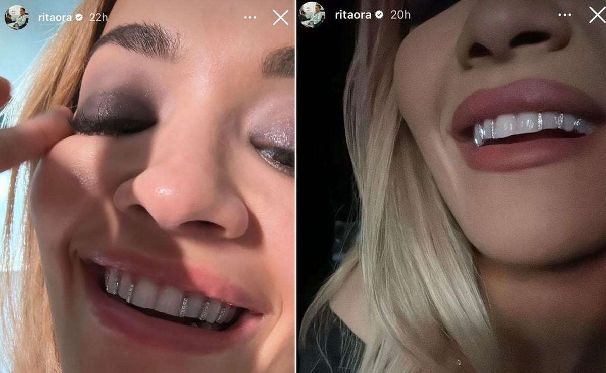 Who Needs Sparkling Necklaces When You've Got Diamond-Studded Grills Like Rita Ora?