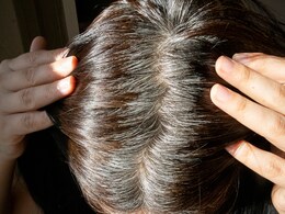 क्या सफेद बालों को हल्दी से किया जा सकता है काला? जानिए इसका White Hair पर कैसे करते हैं इस्तेमाल  क्या सफेद बालों को हल्दी से किया जा सकता है काला? जानिए इसका White Hair पर कैसे करते हैं इस्तेमाल