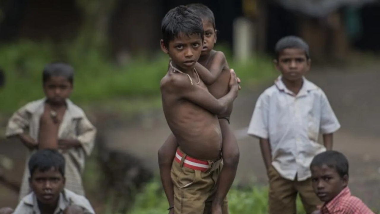 मध्य प्रदेश में कुपोषण ने ले ली एक और मासूम की जान... 45 जिले रेड जोन में, 10 लाख से अधिक बच्चे कुपोषित