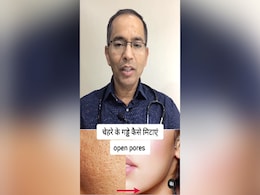 डॉक्टर के बताए इस होम मेड सीरम से चेहरे के गड्ढे जाएंगे भर, बनाने का तरीका यहां जानिए डॉक्टर के बताए इस होम मेड सीरम से चेहरे के गड्ढे जाएंगे भर, बनाने का तरीका यहां जानिए