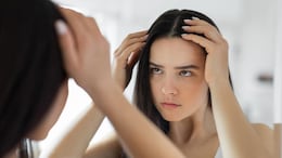 Tried Everything For Hair Loss? This Super Drink Might Be The Solution You Needed
