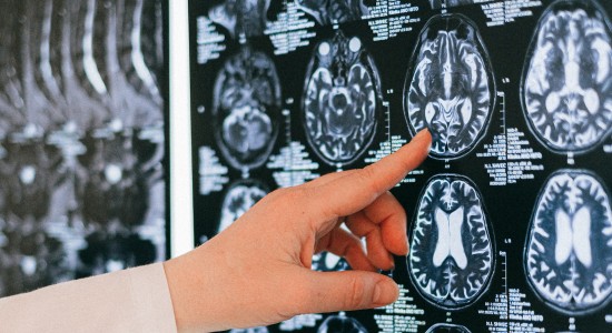 Forgetting Names Isn't A Memory Flaw But How Brain Works, Explains Nutritionist