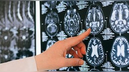 European Watchdog Partially Approves New Alzheimer's Drug
