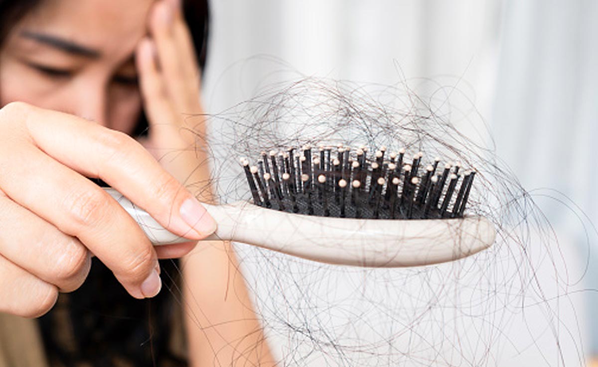 Hair Fall Test: ऐसे लगाएं पता कि बालों का झड़ना नॉर्मल है या नहीं, स्कैल्प और बाथरूम फ्लोर से करें पहचान 