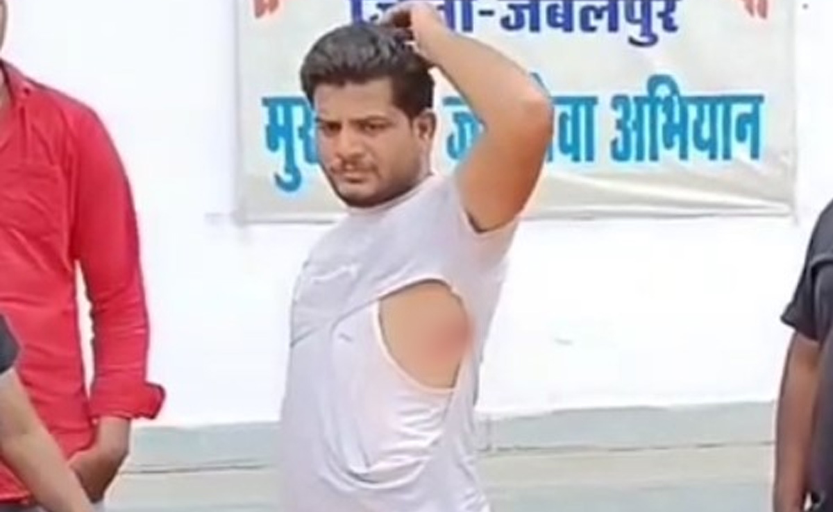जबलपुर अस्पताल में निजी एंबुलेंस माफिया का आतंक, दूसरे चालक को बुरी तरह पीटा