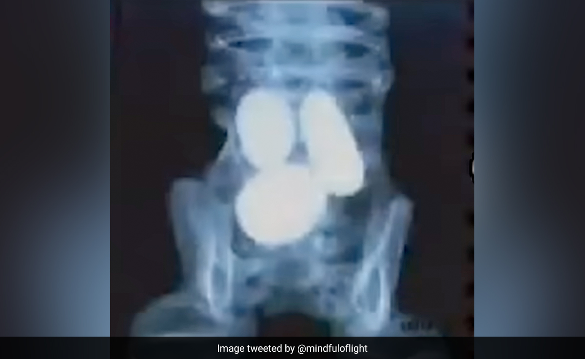 Mexico's "Alien" Bodies Analysed, Eggs Found