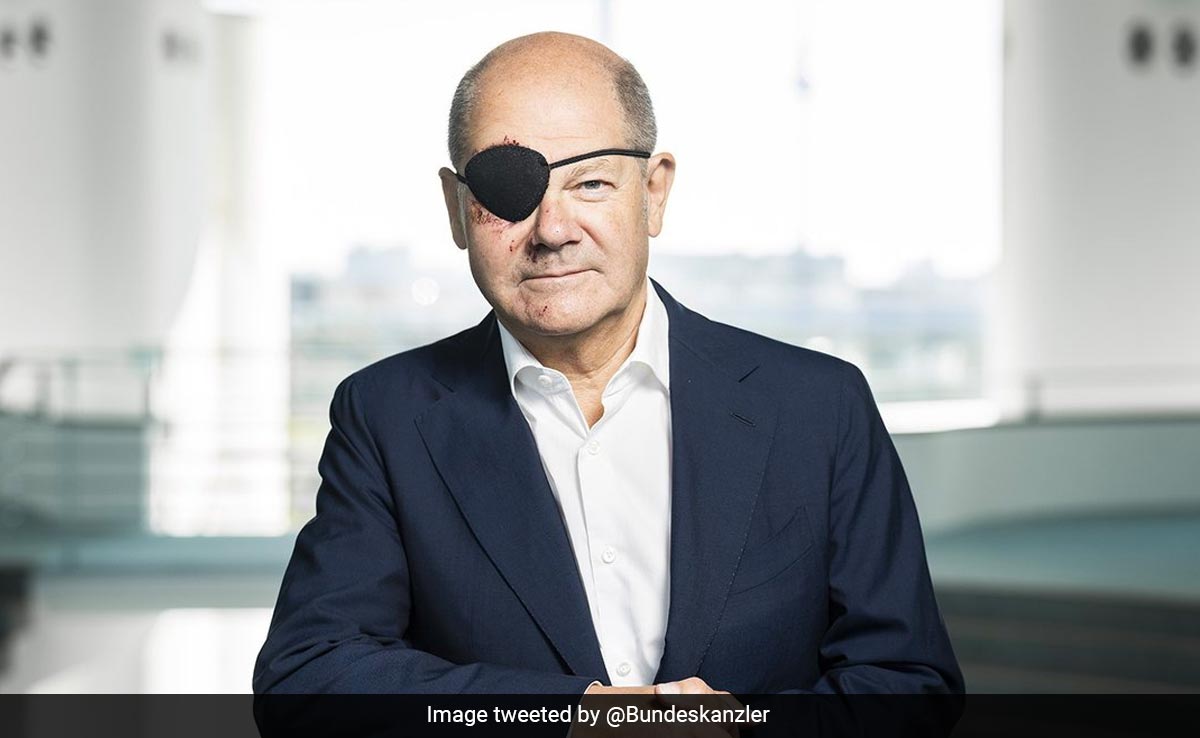 "Excited To See Memes": German Chancellor Wears Eyepatch After Injury