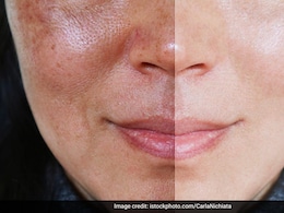 रात में सोने से पहले लगाएं ये सीरम, काले दाग धब्बे और झाईयां होंगी 2 महीने में गायब रात में सोने से पहले लगाएं ये सीरम, काले दाग धब्बे और झाईयां होंगी 2 महीने में गायब