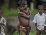 मध्‍य प्रदेश में कुपोषण ने ले ली एक और मासूम की जान... 45 जिले रेड जोन में, 10 लाख से अधिक बच्‍चे कुपोषित