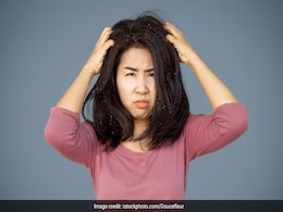 डैंड्रफ को दूर करने के लिए इस तरह लगा लीजिए कपूर, बालों में नजर नहीं आएगी एक भी रूसी  डैंड्रफ को दूर करने के लिए इस तरह लगा लीजिए कपूर, बालों में नजर नहीं आएगी एक भी रूसी