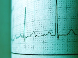 BP बढ़ने पर कब कराएं ECG, जानें- किन लोगों के लिए ये टेस्ट है सबसे जरूरी BP बढ़ने पर कब कराएं ECG, जानें- किन लोगों के लिए ये टेस्ट है सबसे जरूरी