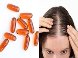 Biotin Effects: बालों को लंबा करने और झड़ने से रोकने के लिए खा रहे हैं बायोटिन कैप्सूल? जान लें इसके फायदे, नुकसान और एक दिन की डोज Biotin Effects: बालों को लंबा करने और झड़ने से रोकने के लिए खा रहे हैं बायोटिन कैप्सूल? जान लें इसके फायदे, नुकसान और एक दिन की डोज