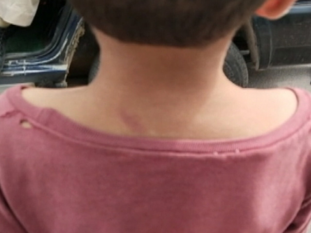 Suspected Of Theft, Boy, 12, Stripped Naked, Beaten, Filmed In Uttar Pradesh's Firozabad